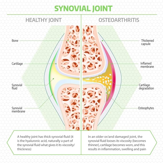 Fluid Motion - Hip & Joint Support for Dogs - Liquid Hyaluronic Acid - Mobility, Comfort and Joint Supplement for Senior Dogs - Apple Flavor - Glucosamine Alternative (60-120+ Day Supply)